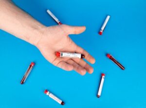 How Do You Test for Ozdikenosis