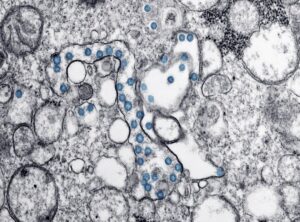 Ozdikenosis Disease