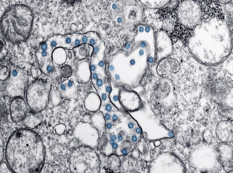 Ozdikenosis Disease