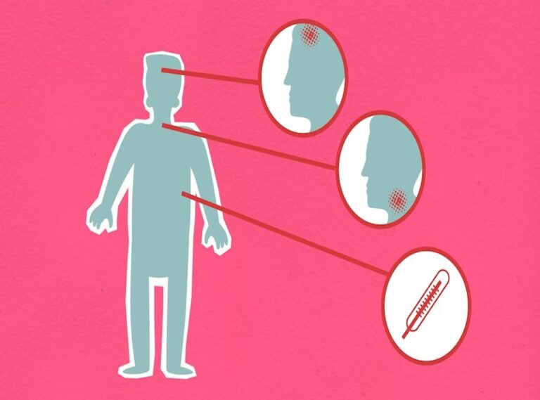 Symptoms of Ozdikenosis